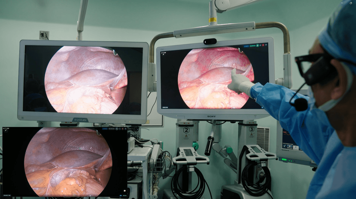 CSM discussion and intra-operative guidance
